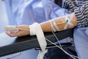 IV Sedation in patients arm
